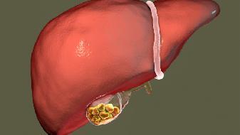 白塞氏病 症状、诊断与治疗