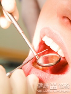 白塞氏病的病因解析